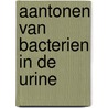 Aantonen van bacterien in de urine door Onbekend