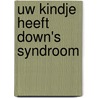 Uw kindje heeft Down's Syndroom door Onbekend