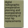 Digital radiographic preoperative planning and postoperative monitoring of total hip replacements by B. The