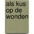 Als kus op de wonden