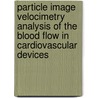 particle image velocimetry analysis of the blood flow in cardiovascular devices by R. Kaminsky