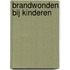 Brandwonden bij kinderen