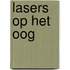 Lasers op het oog