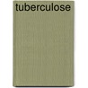 Tuberculose door E. Hueting