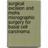 Surgical Excision and Mohs Micrographic Surgery for Basal Cell Carcinoma