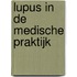 Lupus in de medische praktijk