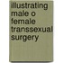 Illustrating Male o Female Transsexual Surgery