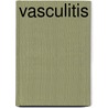 Vasculitis door M. de Booys