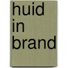 Huid in brand by Unknown