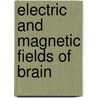Electric and magnetic fields of brain door Rotterdam