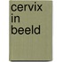 Cervix in Beeld