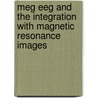MEG EEG and the integration with magnetic resonance images door H.J. Wieringa