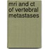 Mri and ct of vertebral metastases