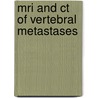 Mri and ct of vertebral metastases door Algra