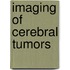 Imaging of cerebral tumors
