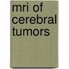 MRI of cerebral tumors door Onbekend