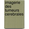 Imagerie des tumeurs cerebrales by G. Wilms