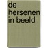 De hersenen in beeld
