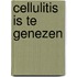 Cellulitis is te genezen