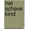 Het scheve kind by B. Peeters