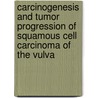Carcinogenesis and tumor progression of squamous cell carcinoma of the vulva door A.G. Emanuels