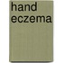 Hand eczema