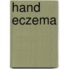 Hand eczema door A.M. van Coevorden