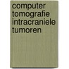 Computer tomografie intracraniele tumoren by Tans