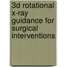 3D Rotational X-Ray Guidance for Surgical Interventions door E. van de Kraats