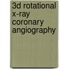 3D rotational X-ray coronary angiography door B. Movassaghi