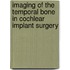 Imaging of the temporal bone in cochlear implant surgery