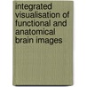 Integrated visualisation of functional and anatomical brain images by R. Stokking