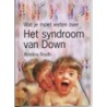 Het syndroom van Down
