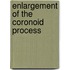 Enlargement of the coronoid process