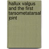 Hallux valgus and the first tarsometatarsal joint door F.W.M. faber