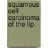 Squamous cell carcinoma of the lip