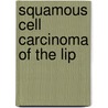 Squamous cell carcinoma of the lip door J.G.A.M. de Visscher