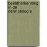 Beeldherkenning in de dermatologie door W. Bergman