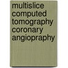 Multislice computed tomography coronary angiopraphy door F. Cadematiri