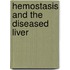 Hemostasis and the diseased liver