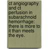 CT Angiography and CT perfusion in Subarachnoid Hemorrhage: there is more to it than meets the eye. door I.C. van der Schaaf