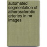 Automated Segmentation of Atherosclerotic Arteries in MR Images by I.M. Adame-Valero