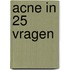 Acne in 25 vragen