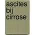 Ascites bij cirrose