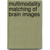 Multimodality matching of brain images by P.A. van der Elsen