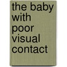 The baby with poor visual contact door I. Casteels