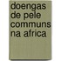 Doengas de pele communs na Africa