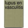 Lupus en vasculitis door Onbekend