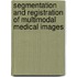 Segmentation and registration of multimodal medical images