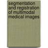 Segmentation and registration of multimodal medical images by F. Maes